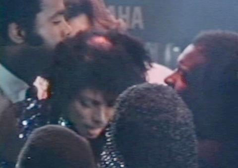 マイケル・ジャクソンさんの、84年のペプシCM火傷事故の写真が公開