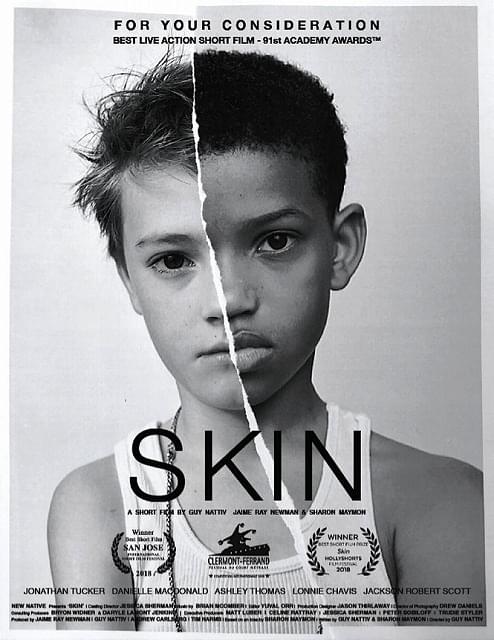 衝撃のラスト！ ジェイミー・ベル主演「SKIN」の基となったオスカー短編、無料配信中