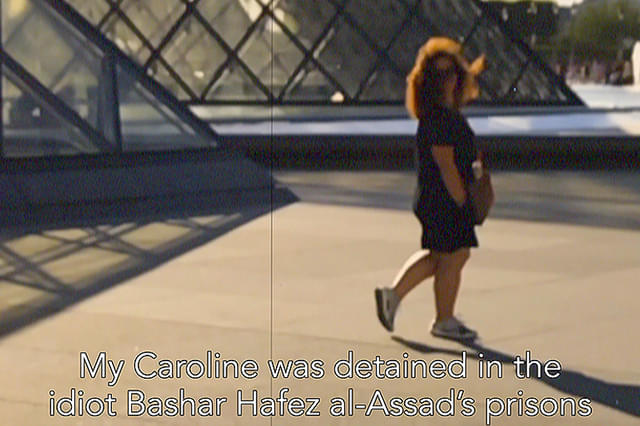 トレパネーション