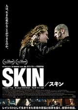 SKIN スキン