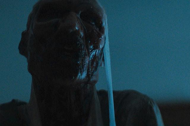 全身の皮がズルむけになってる！